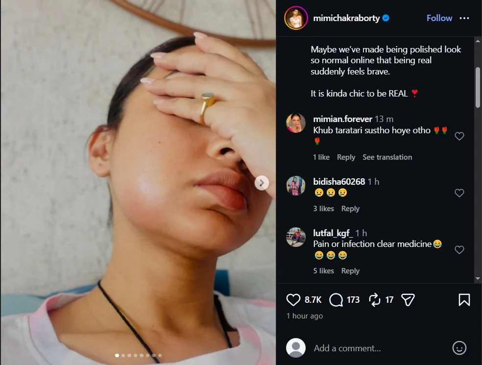 অসুস্থতায় চেহারা বদল, কী হয়েছে ‘দুষ্টু কোকিল’ মিমির? 2 965985552