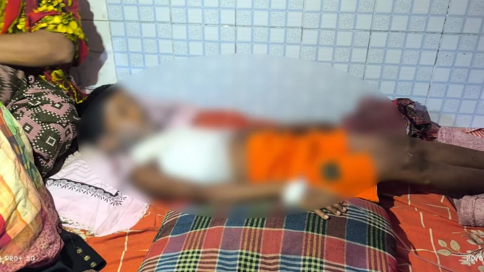 শিক্ষার্থীদের দিয়ে মিড ডে মিলের ডিম সেদ্ধ, ফুটন্ত পানিতে দগ্ধ ১