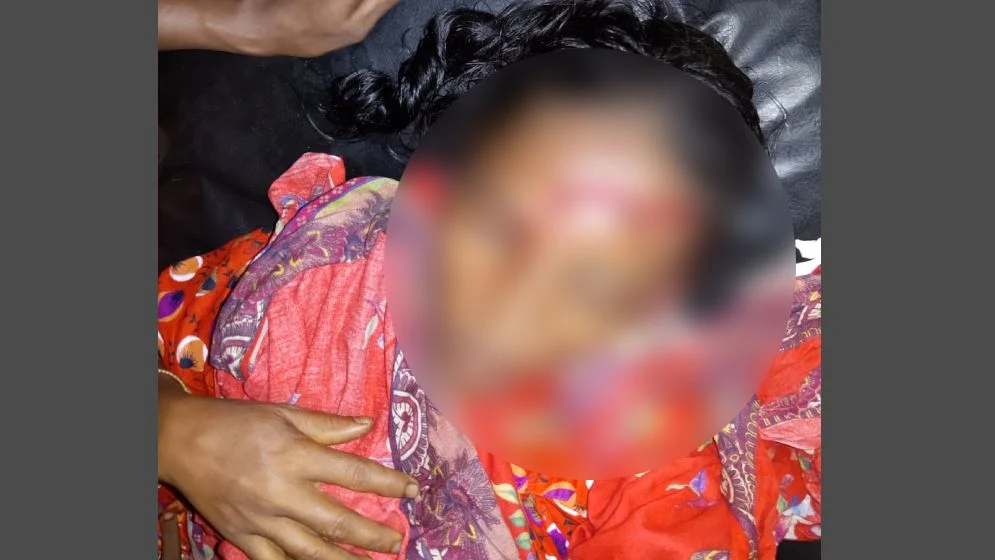সুন্দরগঞ্জে শেয়ালের আক্রমণে আহত ৯